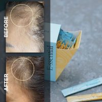 ruvine e-ssential